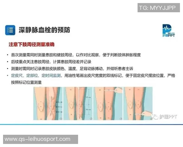 文班谈血栓伤病的医学分析与心理状态的积极应对 文班谈血栓伤病的医学分析与心理状态的积极应对